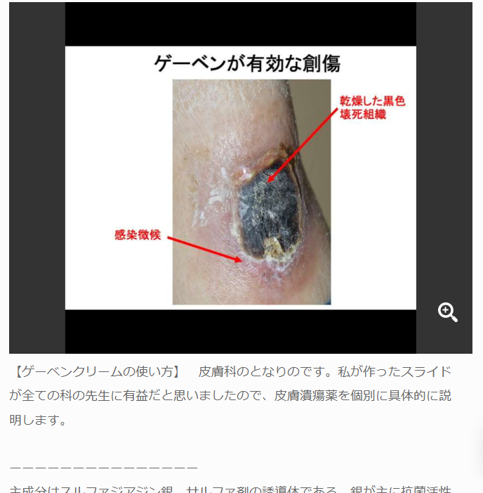 ゲーベンクリームの使い方