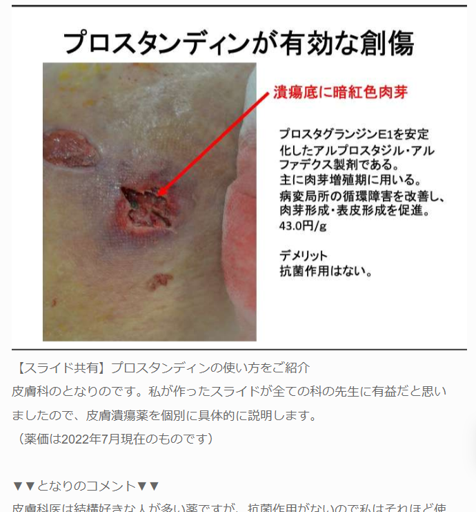 プロスタンディンの使い方