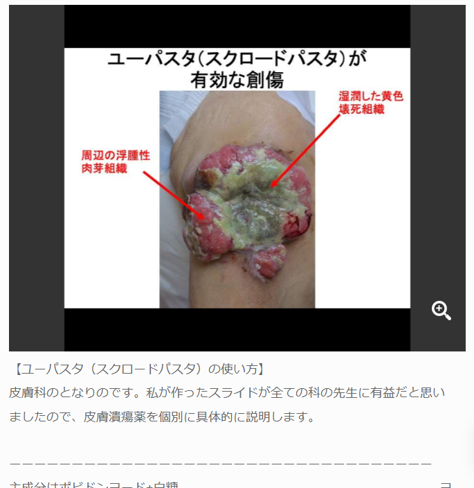 ユーパスタ（スクロードパスタ）の使い方